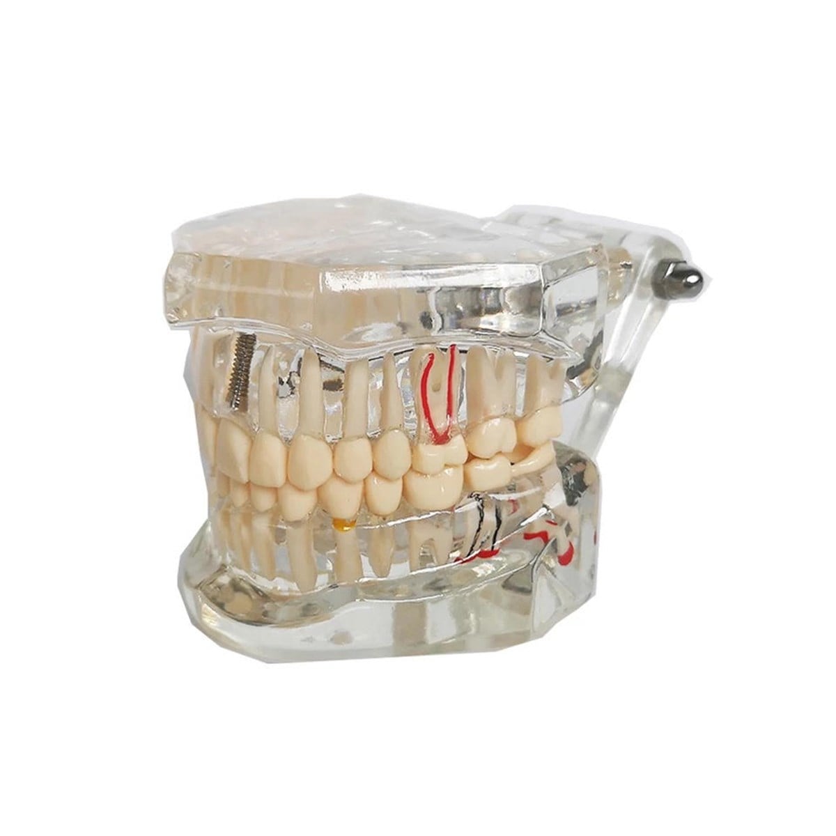 Omega Typodont Çene Patolojik Diş Hekimliği Eğitim Modeli